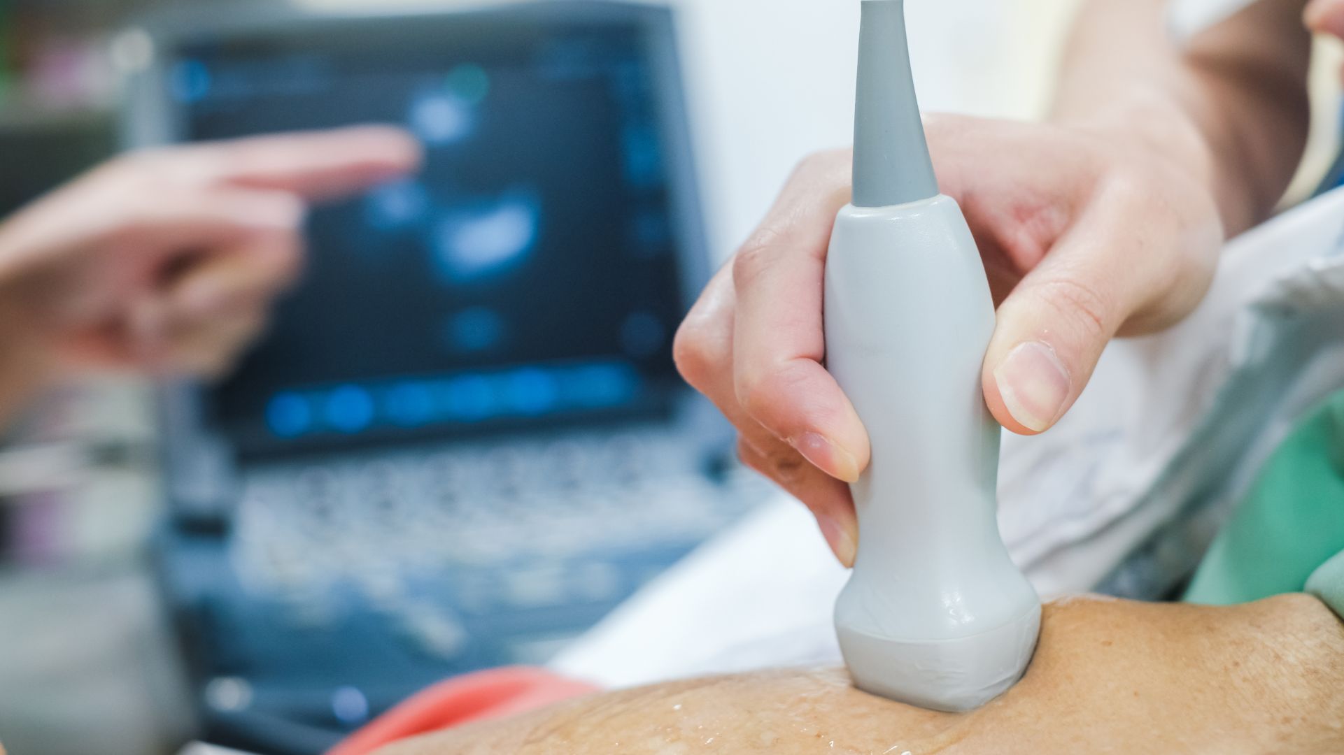 Medis Medical Imaging and GE HealthCare announce collaboration focused on non-invasive coronary assessments 